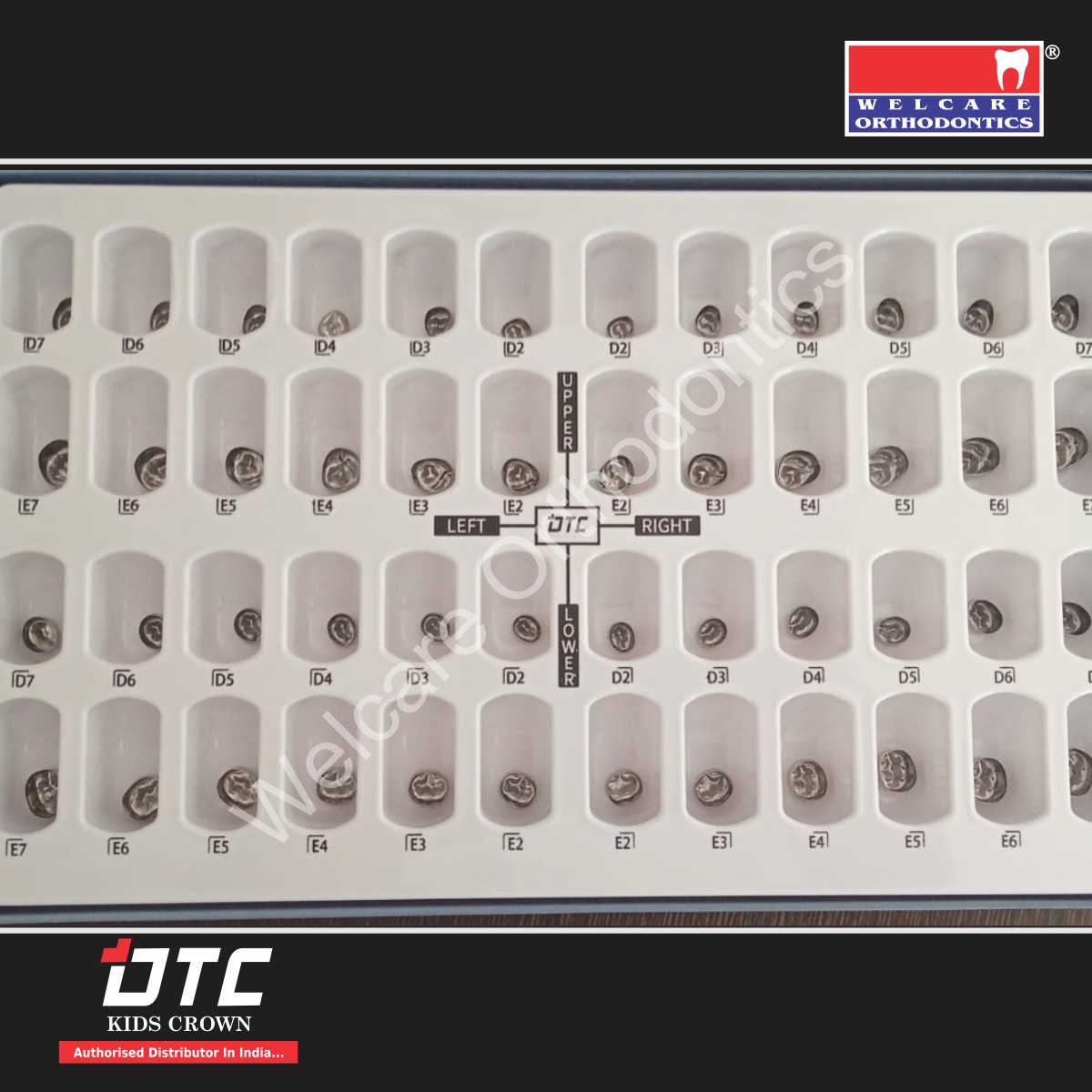 PEDO CROWN (SS) 48 PCS  - DTC