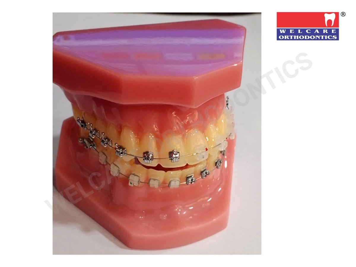 ORTHODONTIC STUDY MODULE WITH BRACKET  – WELCARE