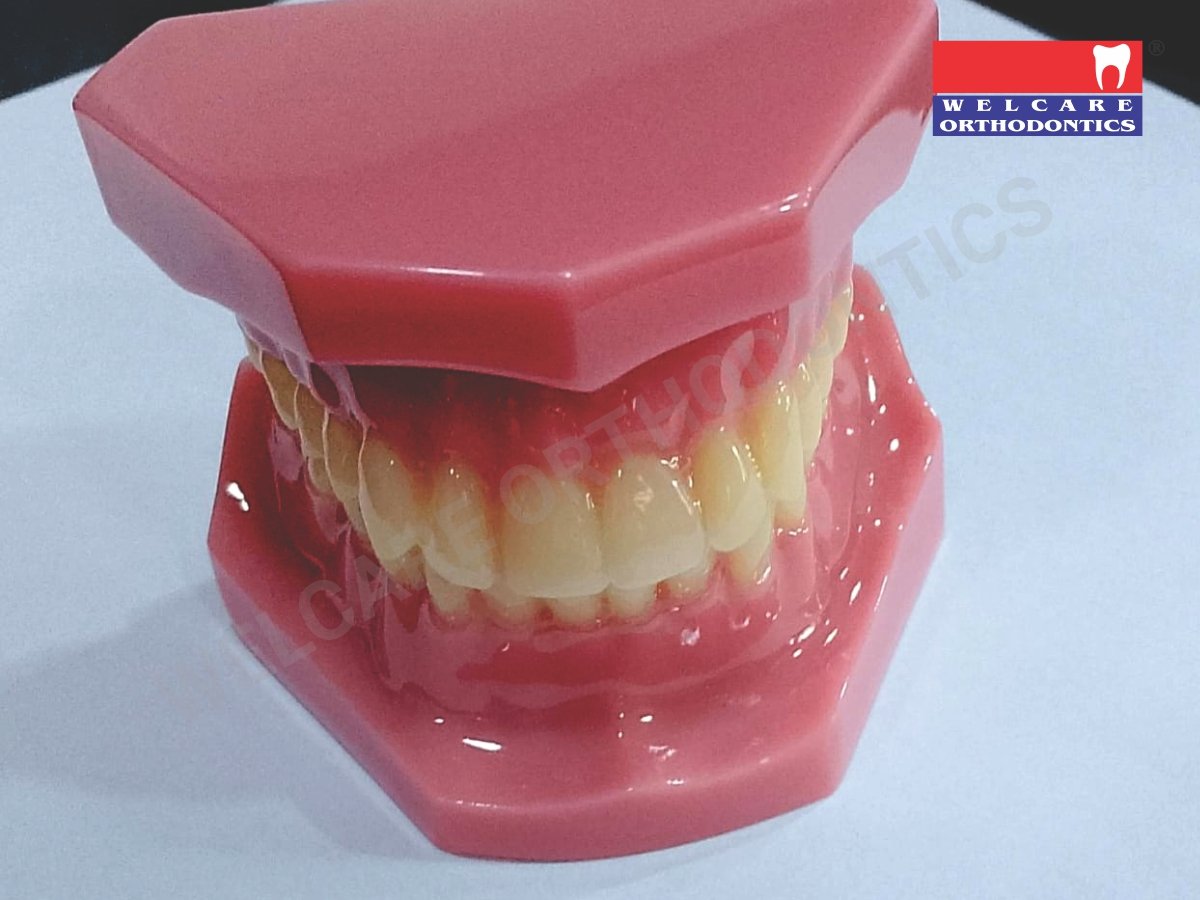 ORTHODONTIC STUDY MODULE WITHOUT BRACKET PLAIN   – WELCARE